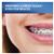 Oral B Interdental Brushes 10 Pack